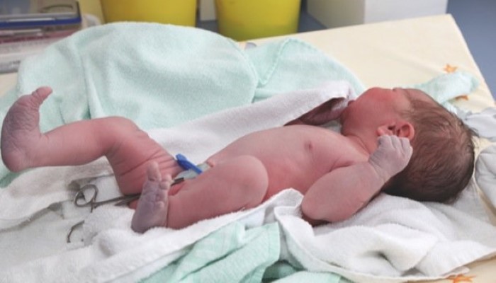 Organes génitaux du bébé gonflés après la naissance - Bébés et Mamans