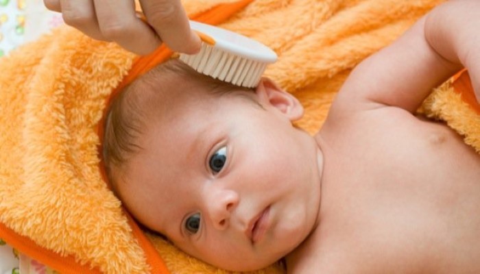 Croûtes de lait de bébé : qu'est-ce que c'est et comment les traiter ?