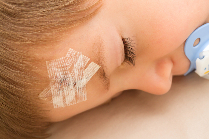 Réduire les marques des cicatrices chez les bébés - Bébés et Mamans
