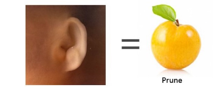 Grossesse - Semaine 12