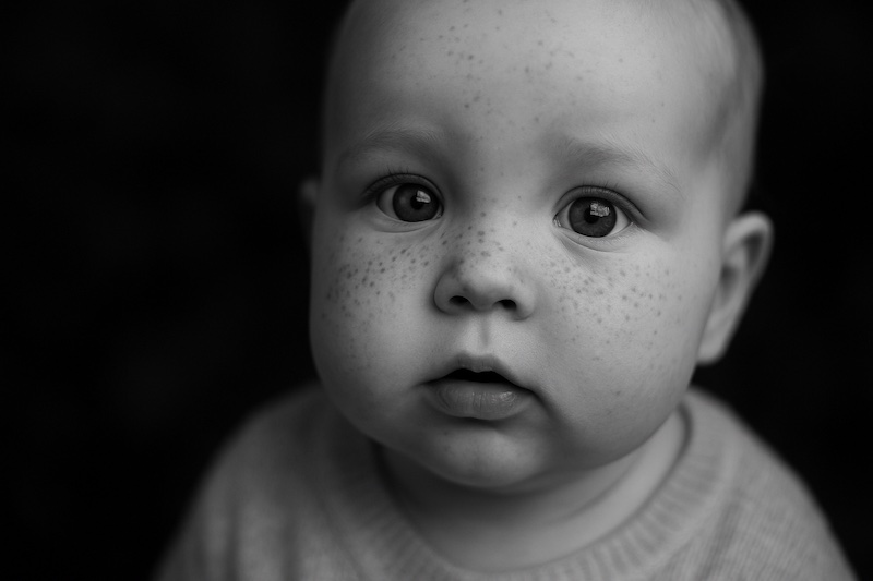 Mon bébé a des Taches café au lait, taches de rousseur et grains de beauté Mon bébé a des Taches café au lait, taches de rousseur et grains de beauté