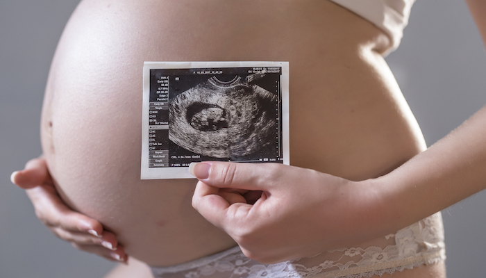 Femme enceinte tenant son ventre Femme enceinte tenant son ventre