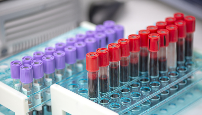 Tube avec un prélèvement de sang