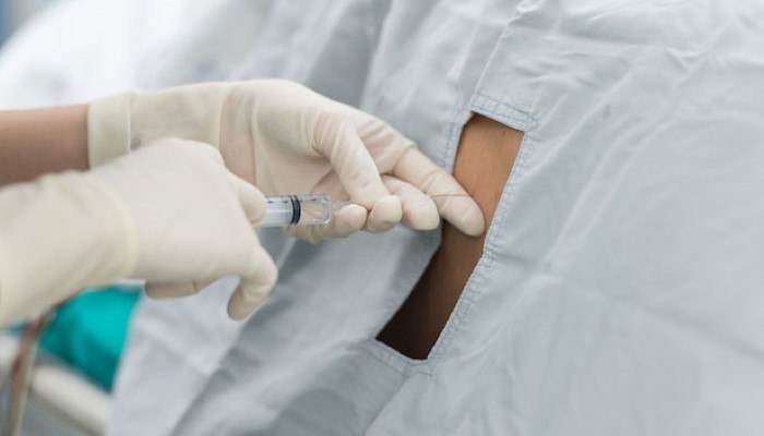 Péridurale déambulatoire Péridurale déambulatoire