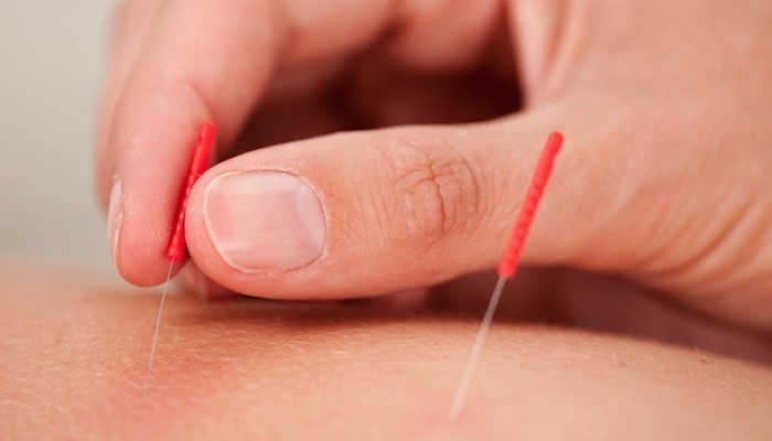 Accoucher sans douleur et sans péridurale Accoucher sans douleur et sans péridurale