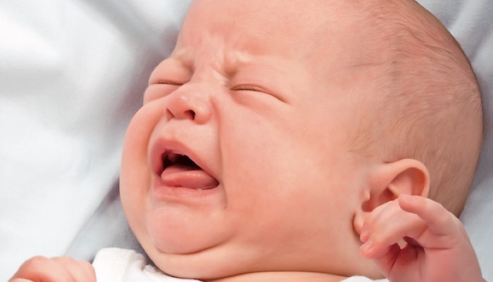 Bébé avec une obstruction du canal lacrymal Bébé avec une obstruction du canal lacrymal