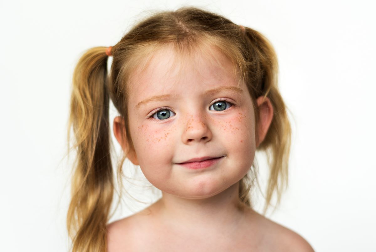 Mon enfant a des taches jaunes sur le visage Mon enfant a des taches jaunes sur le visage
