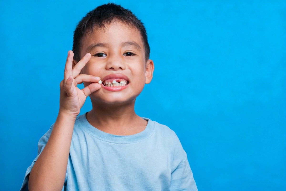 Dents de lait tordues