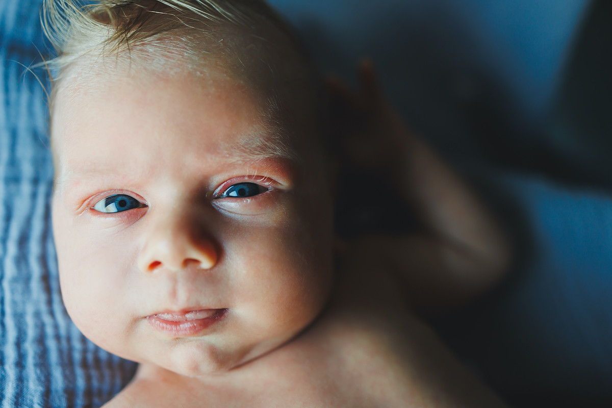 Opération du canal lacrymal