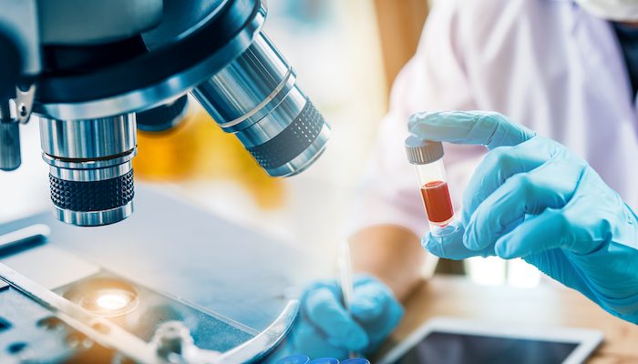 Faible teneur en protéines pendant la grossesse