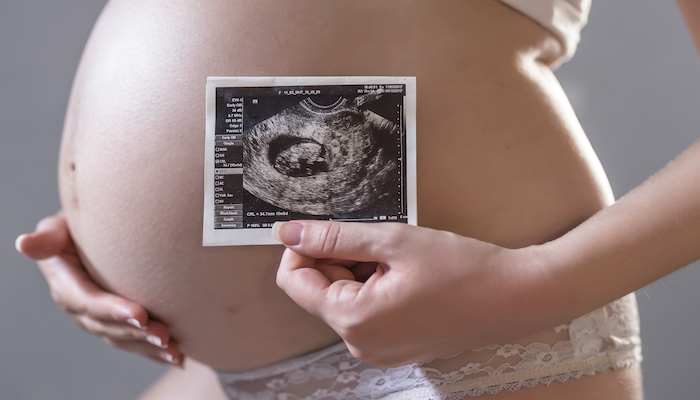 Augmentation du liquide amniotique