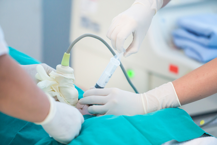 Une amniocentèse Une amniocentèse