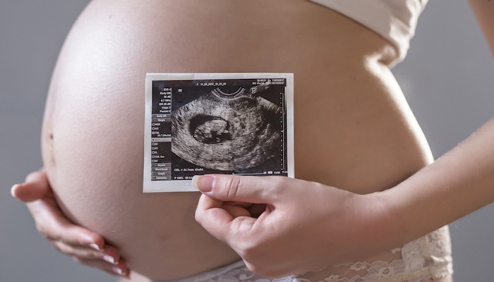 Résultat dépistage syndrome de Down