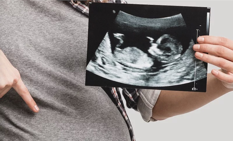 Le Sac Gestationnel Le Sac Gestationnel