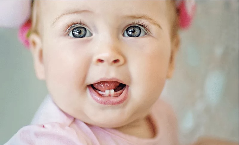 Problèmes bucco dentaires des bébés