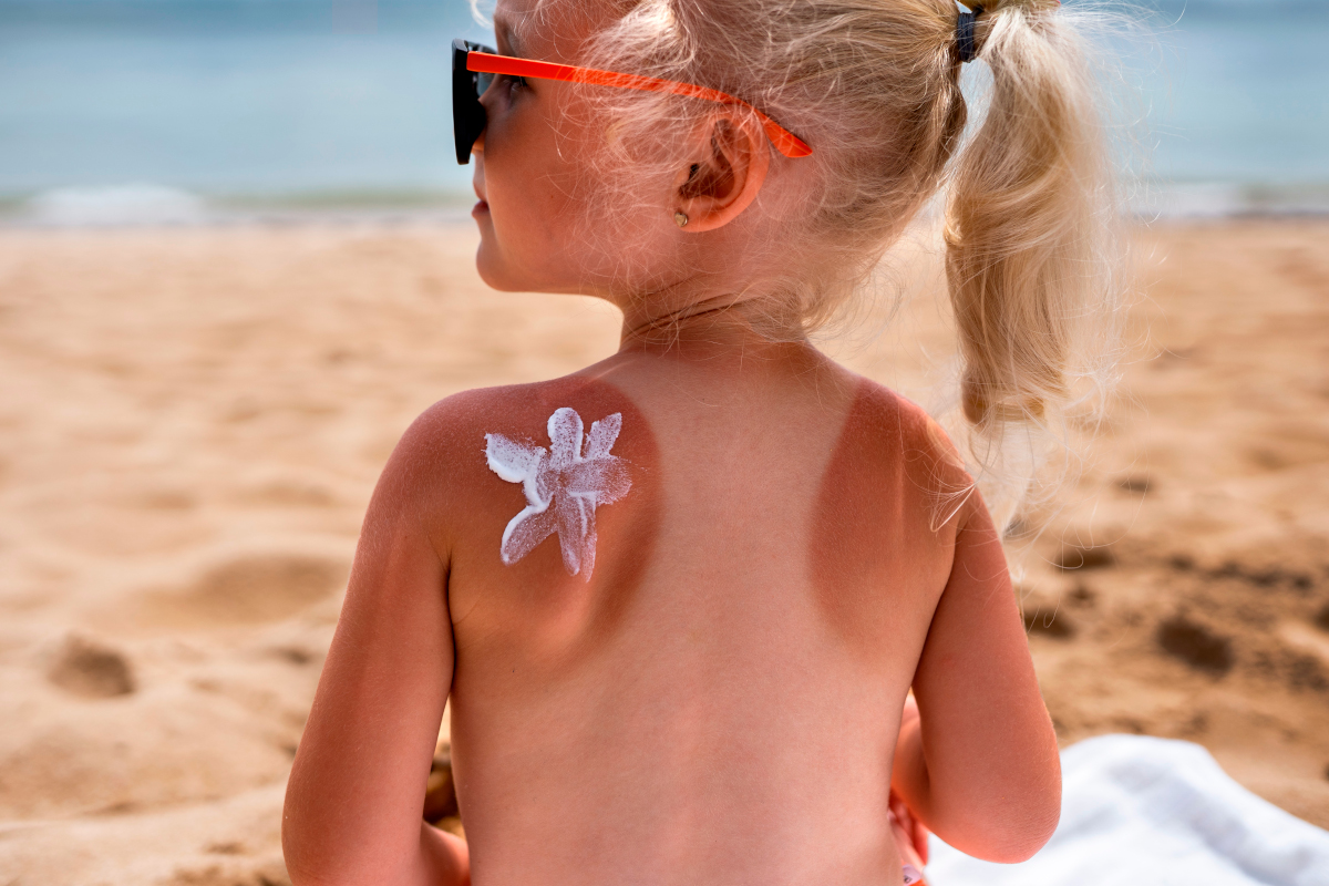 Coup de soleil enfant en juillet-août Coup de soleil enfant en juillet-août