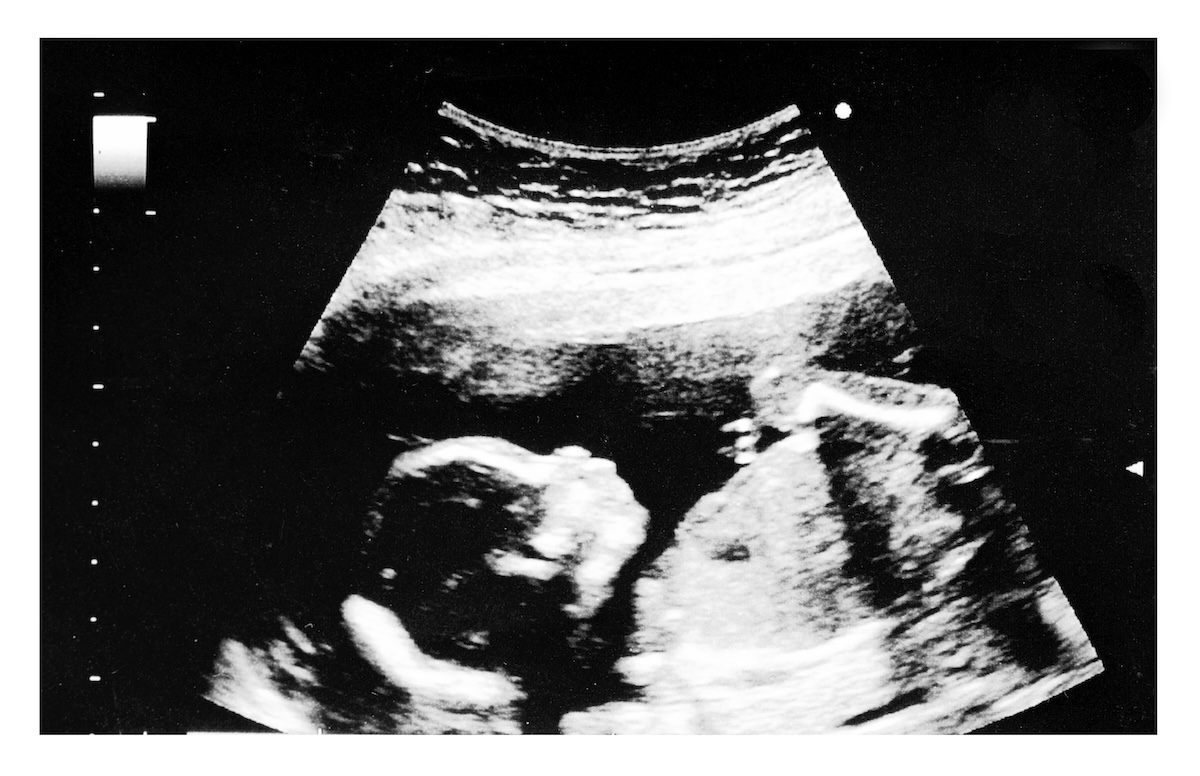 Polska enceinte