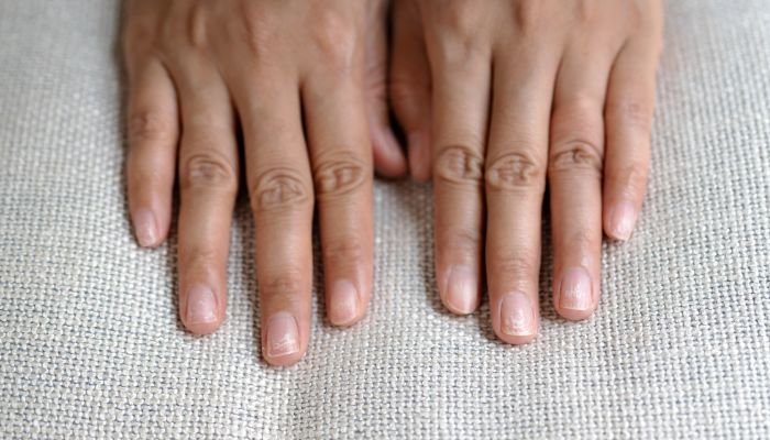 tache blanche sur les ongles tache blanche sur les ongles