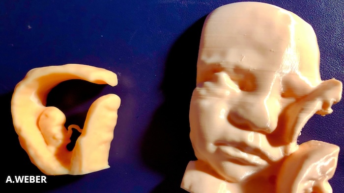 Moulage 3D d’une échographie braille