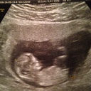 https://bebesetmamans.20minutes.fr/images/groupphotos/27/249/thumb_fa6b8faf32fc5fd6bba2ae85.jpg