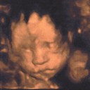 https://bebesetmamans.20minutes.fr/images/groupphotos/34/706/thumb_fda87f705e7471a4d4029e30.jpg